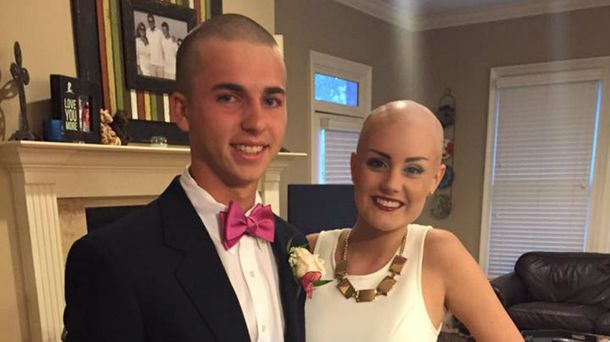 Su pareja tiene cáncer, así que se rapó para ir juntos a una fiesta en el colegio