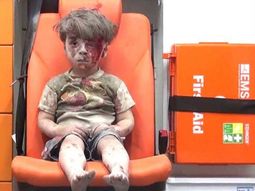 ¿Cómo está el nene sirio que quedó ensangrentado tras un bombardeo?