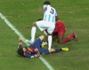Un jugador del Barcelona recibió un violento pisotón