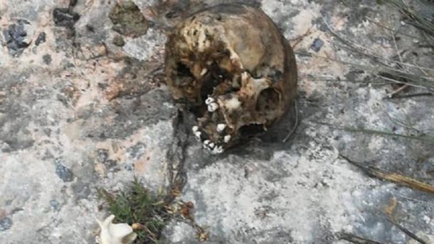 Misterio en Santa Fe: encuentran un cráneo humano en plena calle de la ciudad