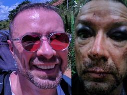 Sufrió un accidente, se sacó una selfie y descubrió que casi muere Sufrió un accidente, se sacó una selfie y descubrió que casi muere