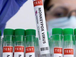 Intensifican controles en aeropuertos y pasos fronterizos por la viruela del mono