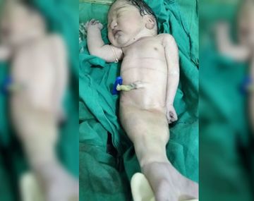 La triste historia de la sirenita que no logró sobrevivir