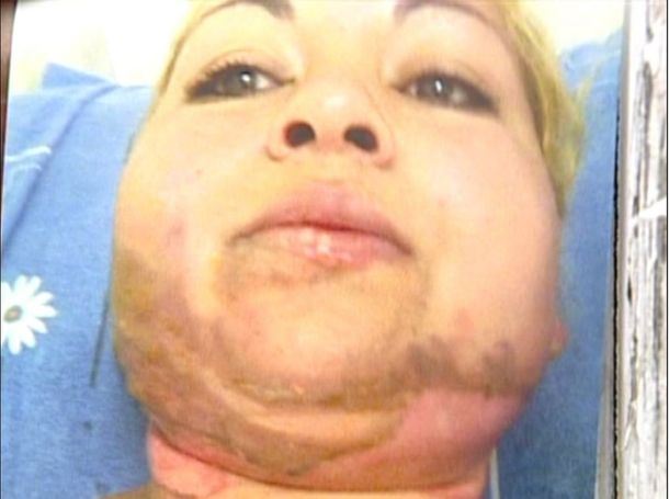 Quemada monte grande