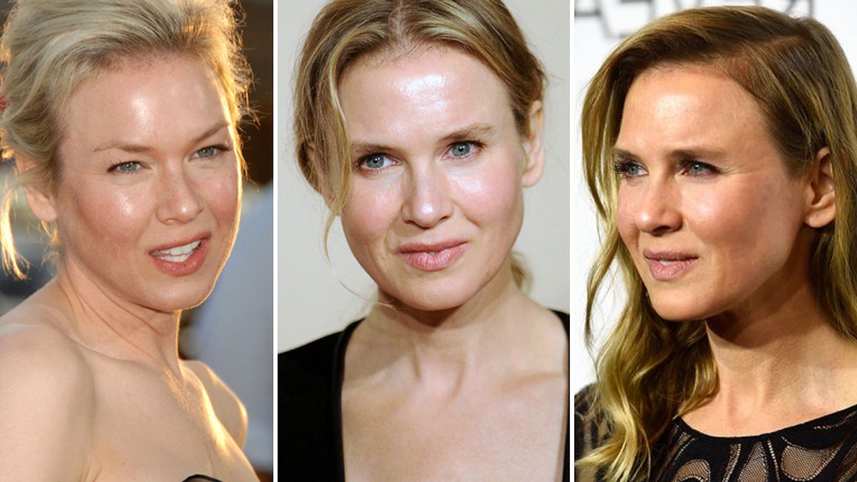 renee-zellweger-looks-cirugiasjpg