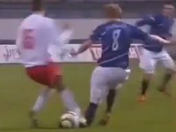 la lesion mas impresionante: se rompio la tibia la lesion mas impresionante: se rompio la tibia