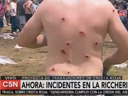 video: asi resulto herido un manifestante en la protesta de cresta roja video: asi resulto herido un manifestante en la protesta de cresta roja