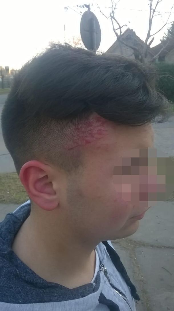 Así lo golpeó para robarle el celular