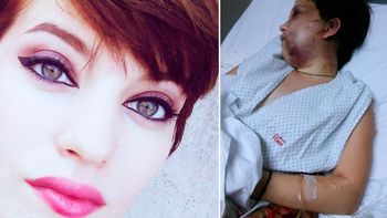 Así quedó Belén luego del brutal ataque del anestesista Así quedó Belén luego del brutal ataque del anestesista