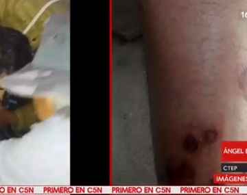 Denuncian que la policía reprimió con balas una toma de tierra y mató un militante