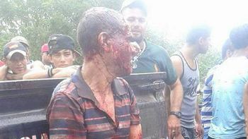 Un hombre decapitó a un joven y fue linchado por los vecinos en Nicaragua Un hombre decapitó a un joven y fue linchado por los vecinos en Nicaragua