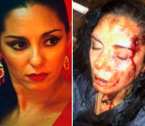 Bailarina de flamenco recibió una brutal golpiza de su ex