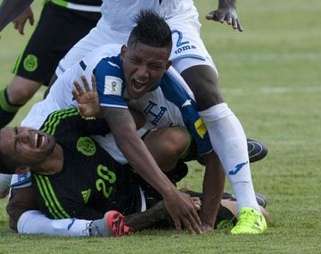 Espeluznante lesión de un futbolista hondureño en el partido ante México