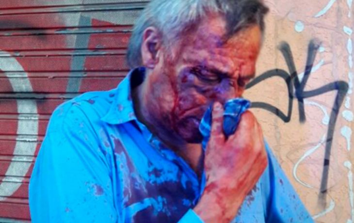 Cuatro líneas de colectivo están de paro por un brutal ataque a un chofer