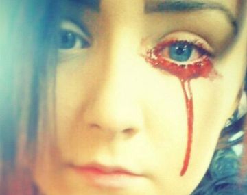 Una adolescente no para de sangrar por los ojos y nadie sabe las causas