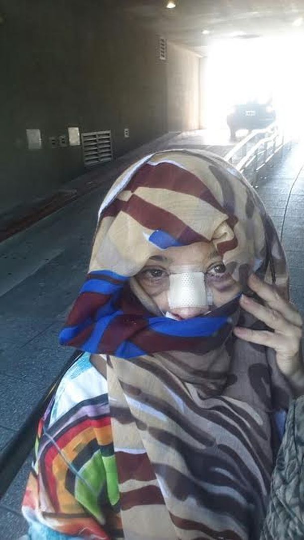 Así quedó Marcela Feudale después de operarse la cara