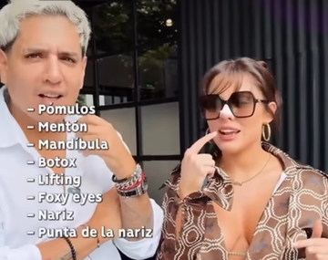 La Reini contó sin filtros todas las intervenciones estéticas que se realizó