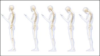 como afecta a la columna el uso prolongado del celular como afecta a la columna el uso prolongado del celular