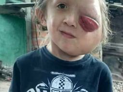 Tobías tiene 7 años