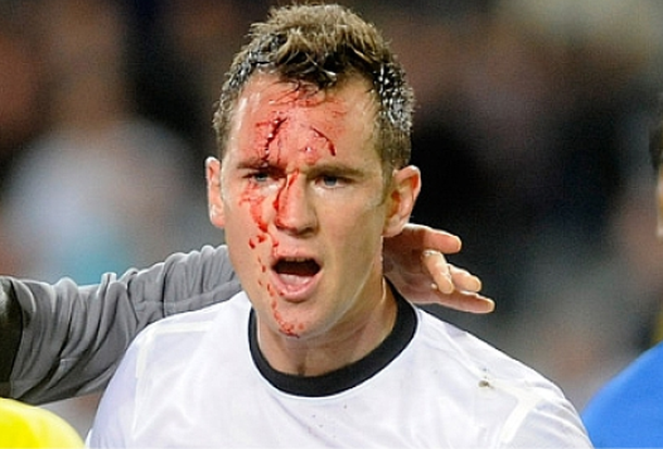 Le dieron un planchazo en la cara pero el árbitro no cobró penal