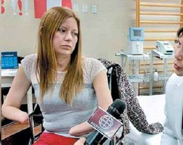 Le amputaron las manos y pies por error