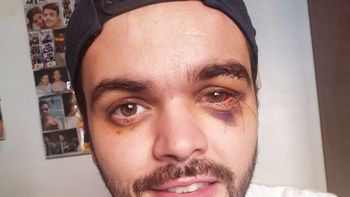 Jonathan Castellari: Mi vieja me dijo que hubiera preferido abortarme Jonathan Castellari: Mi vieja me dijo que hubiera preferido abortarme