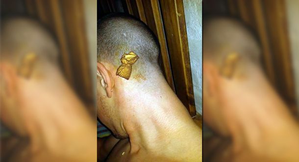 Sacó a pasear a su perra, lo acusaron de maltrato y le pegaron en la cabeza