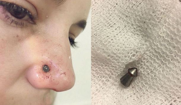 La mujer tuvo que ser atendida en un centro médico cercano