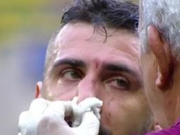 El ex delantero de Vélez podría jugar con una máscara El ex delantero de Vélez podría jugar con una máscara