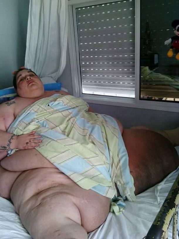 Pesa más de 300 kilos y pide asistencia: Los médicos se asustan y no quieren verme