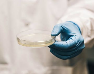 Desarrollaron un método para prevenir el&nbsp;Síndrome Urémico Hemolítico (SUH)