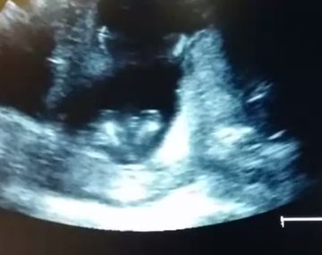 ¿Un feto de 14 semanas aplaude?