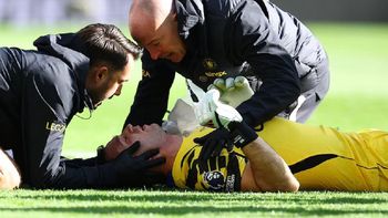 el dibu martinez tuvo que ser intervenido por una fractura en la mandibula y estara un tiempo sin poder jugar el dibu martinez tuvo que ser intervenido por una fractura en la mandibula y estara un tiempo sin poder jugar