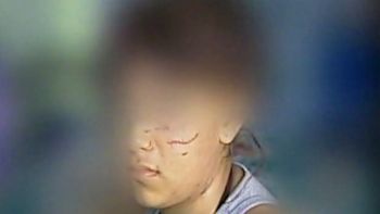 brutal caso de bullying contra una adolescente de 14 anos