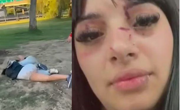 Quién es Anahí, la tiktoker atacada por linda a la salida de un boliche de General Pacheco