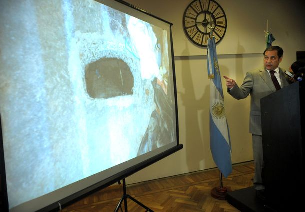 Hortel negó que con Marambio vaya a volver la garroterapia