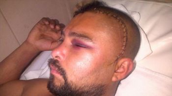 un hombre perdio el habla luego de sufrir una brutal golpiza a la salida de una fiesta un hombre perdio el habla luego de sufrir una brutal golpiza a la salida de una fiesta