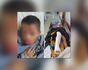 La Plata: atropelló a un nene de 4 años y se fugó