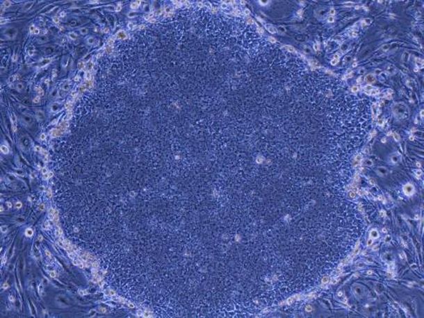 Comienza en Japón el primer ensayo de células madre IPS en humanos