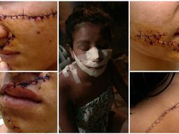 La desfiguraron por ser linda