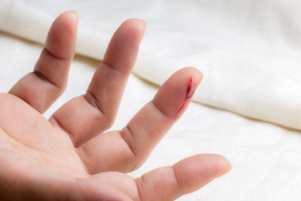 ¿Por qué duele tanto cortarse con papel?