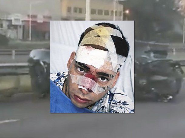 Kaleb Di Masi chocó contra un patrullero en Acceso Oeste