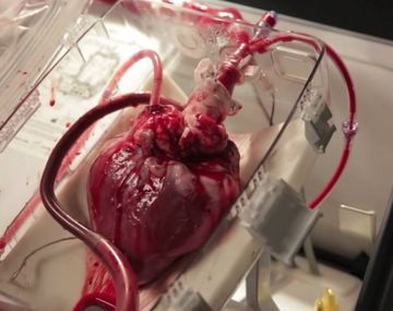Video: un corazón sigue latiendo artificialmente dentro de una caja
