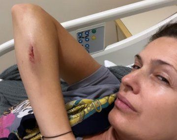 Isabel Macedo sufrió un accidente doméstico y terminó en el hospital: Un susto inmenso