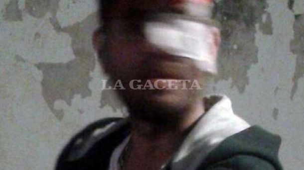 Carlitos Nair recibió una golpiza en un boliche tucumano