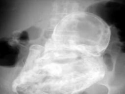 a los 82 anos, descubrio que habia estado embarazada por 40 anos a los 82 anos, descubrio que habia estado embarazada por 40 anos