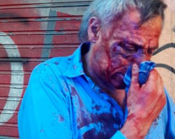 Cuatro líneas de colectivo están de paro por un brutal ataque a un chofer