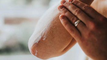 anmat prohibio una serie de cremas terapeuticas y productos para piletas: de cuales se trata anmat prohibio una serie de cremas terapeuticas y productos para piletas: de cuales se trata