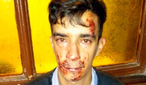 Brutal ataque de una patota de adolescentes a un electricista en La Plata