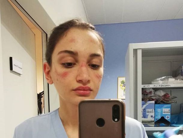 El mensaje y las fotos de dos enfermeras agotadas por el coronavirus